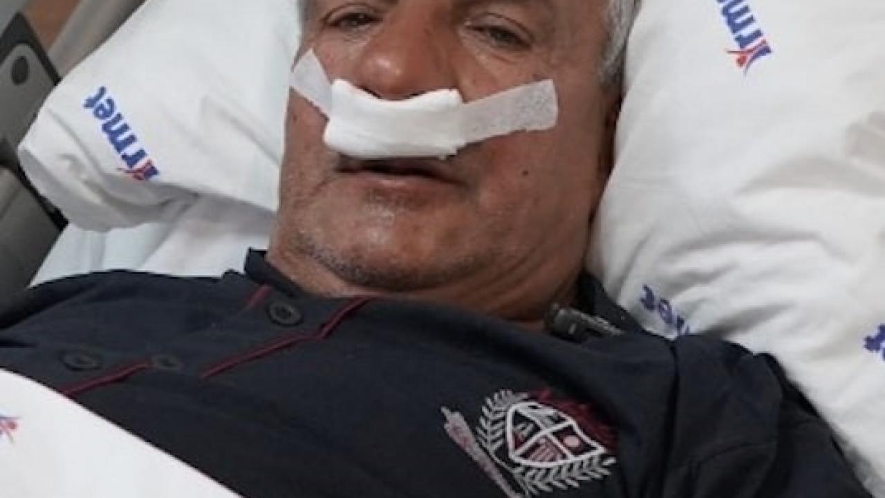 27 yıllık mesleğin şaşırtan sonucu: Burnundan 100 gramlık taş çıktı